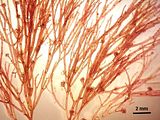 3 - Tetrasporofito con assi fertili inseriti sulle cellule assiali